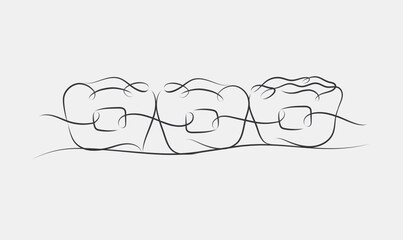 Teeth braces illustration drawing in linear style on white color background