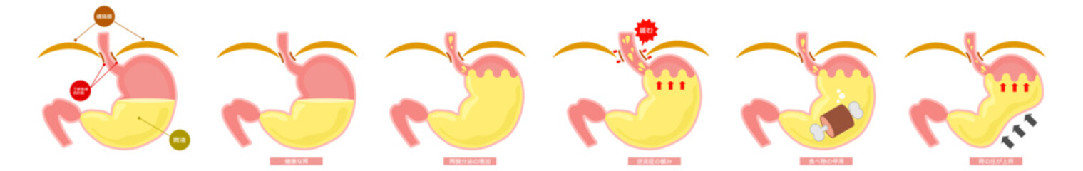 胃袋　胃液異常セット※Affinity Designer作成svgファイル