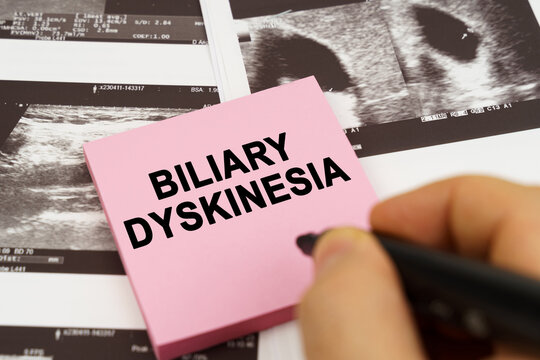 On the ultrasound pictures there are stickers that say - Biliary dyskinesia