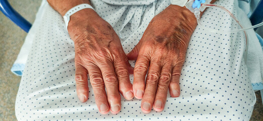 Elderly hands with osteoarthritis and venous catheter