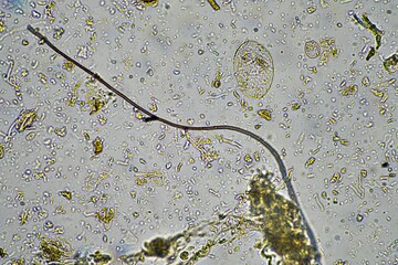 microscopic forest fungal hyphae in a soil sample