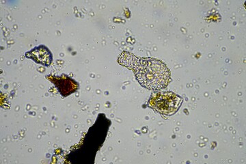 soil sample containing soil biology, with bacteria, fungi, amoeba, flagellate, and arcella, on a...
