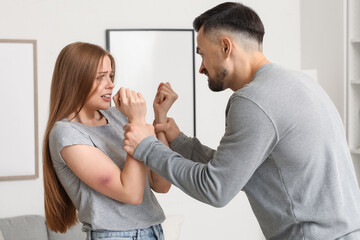 Bruised young woman and her angry husband at home. Domestic violence concept