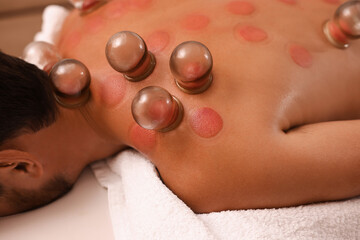 Cupping therapy. Closeup view of man with glass cups on his back indoors