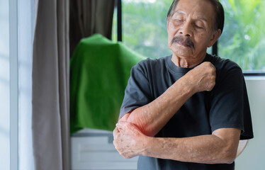 Old Asian man hand holding his elbow suffering from elbow pain. Senior man suffering from pain in...