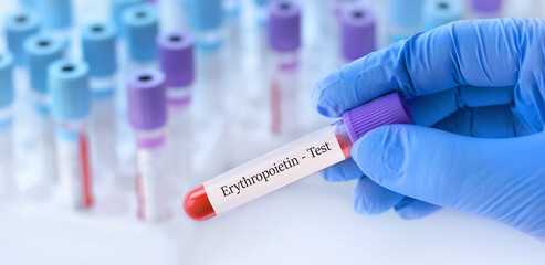 Doctor holding a test blood sample tube with erythropoietin test on the background of medical test...