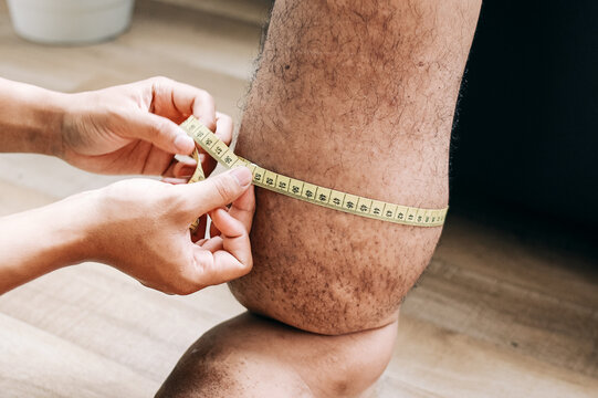 Doctor measuring patient foot that suffering from filariasis or lymphatic filariasis with tape in clinic 
