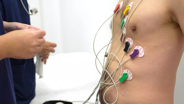 Cardiologists placing electrodes to a patient performing a stress test