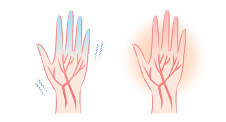 末端冷え性　血の巡りが悪い冷えた指先と温かい指先のイラスト