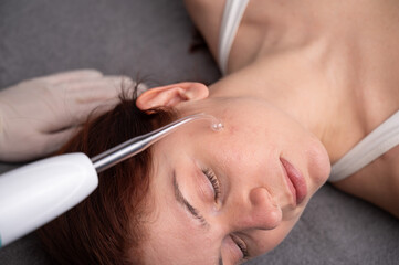 The doctor uses the darsonval apparatus against acne on the face of a female patient.