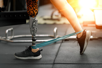 prosthetic, artificial leg. Woman with prosthetic leg using walking on treadmill while working out in gym. artificial leg. Woman wearing prosthetic equipment sit down after exercising  in gym. - obrazy, fototapety, plakaty
