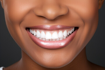 A woman grins displaying her beaming pearly whites in a closeup.