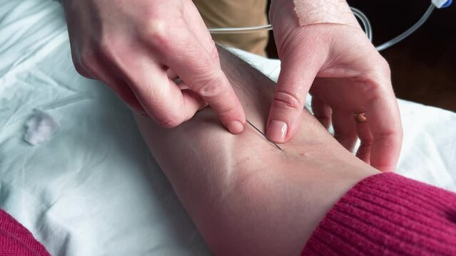 Nurse puts an IV on a man. POV of a man's arm with an IV needle in the median cubital vein (antecubital vein). A person is receiving intravenous fluid. Intravenous injections, medical care in a clinic