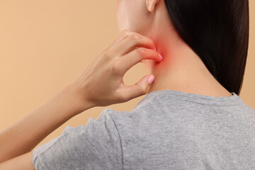 Suffering from allergy. Young woman scratching her neck on beige background, back view