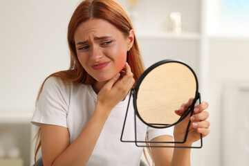 Suffering from allergy. Young woman looking in mirror and scratching her neck at home