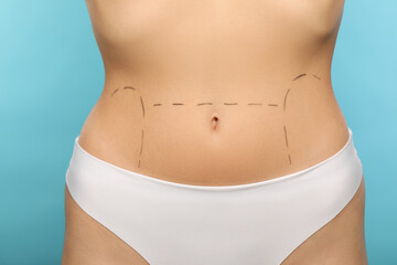 Slim woman with markings on belly before cosmetic surgery operation on light blue background,...