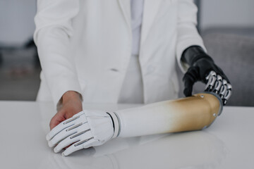 Cropped image on woman with cyber arm taking new artificial bionic arm placed on table. Hi tech...