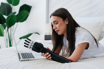 Young girl attaching artificial cyber arm laying on bed using laptop exploring instructions of electronic bionic limb. Hi tech medicine, future technologies. - obrazy, fototapety, plakaty