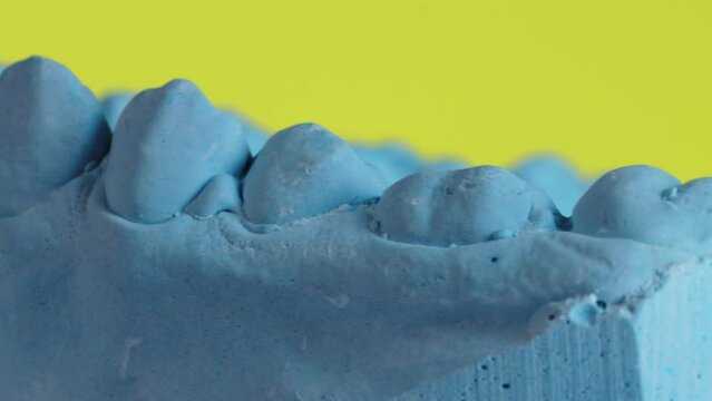 A blue plaster cast of a dental jaw rotates on a yellow background. The concept of making new dental crowns and dentures based on the patient s impression. Dental surgery and orthopedics in dentistry.