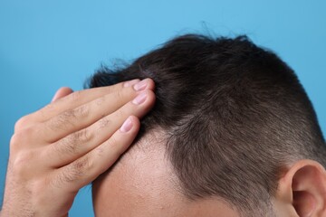 Fototapeta premium Man examining his head on light blue background, closeup. Dandruff problem