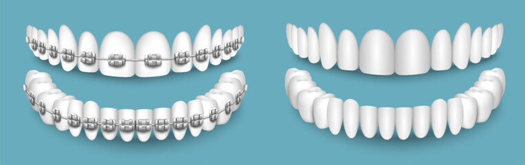 Teeth with or without braces orthodontic dentistry - obrazy, fototapety, plakaty