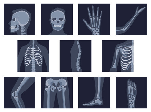 Human bones orthopedic and skeleton icon set, bone x-ray image of human joints, anatomy skeleton flat design vector illustration