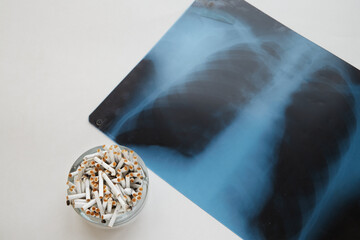 A chest X-ray lies on a white table next to an ashtray full of cigarette butts. The dangers of smoking, health and cigarettes, lung inflammation caused by smoking