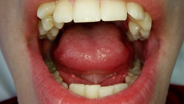 Inside the open mouth. The jaw, palate, gums, tongue and throat of a man. Concept of medicine and health care. Macro shot.