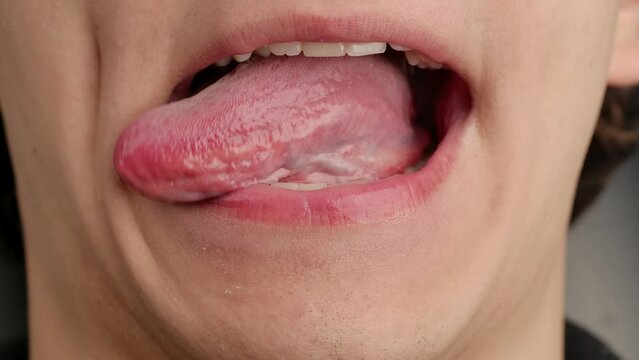 Male tongue. Articulation exercises for the tongue. Training of the speech apparatus, muscles of the tongue in speech therapy practice, improving diction. Macro shot.