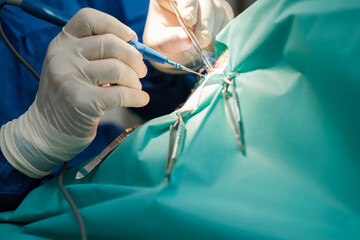 Surgeon's hands with electroscalpel making a surgical incision. Concept: emergencies, operation