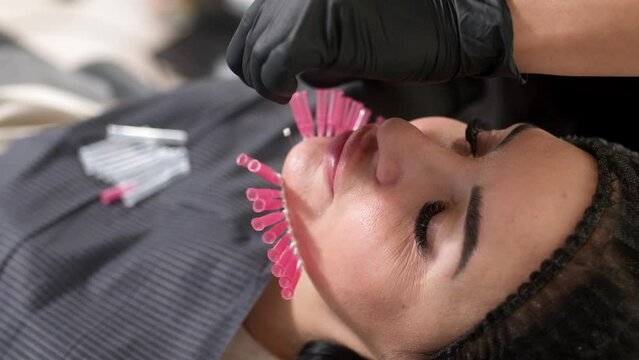 Woman undergoes a face lift procedure. Facial skin care, anti-aging face contour correction. The beautician implants cosmetic threads under the skin to relieve facial ptosis. 