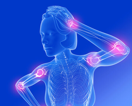 3d illustration of woman torso with joint pain. Showing the anatomy of the transparent internal skeleton. On blue background.