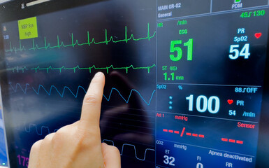 hospital monitor displaying vital signs and hemodynamics, illustrating healthcare and patient...