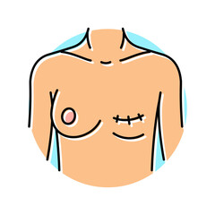 mastectomy surgery surgery color icon vector. mastectomy surgery surgery sign. isolated symbol illustration