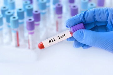 Doctor holding a test blood sample tube with STI (sexually transmitted infection) test on the background of medical test tubes with analyzes - obrazy, fototapety, plakaty
