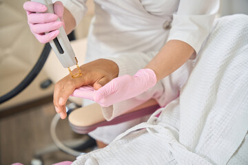 Client at a laser hair removal session for the hands