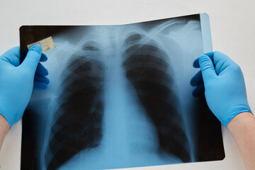 x ray image of a person in a hospital