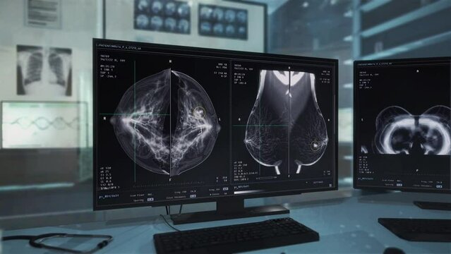 Medical examination x-ray scanner analysing the female breast. Medical exam x-ray system examining the woman chest. Medical exam x-ray detecting the cancerous cells inside the patients chest.