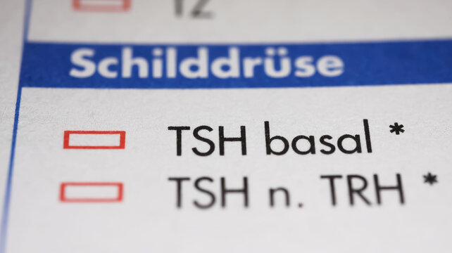 Viersen, Germany - May 9. 2023: Closeup of lab sheet for medical diagnostics thyroid stimulating hormone TSH blood test