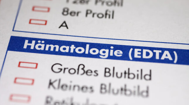 Viersen, Germany - May 9. 2023: Closeup of lab sheet for medical diagnostics Hematology blood count test