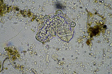 microorganisms and a tardigrade in a soil sample on a farm under the microscope