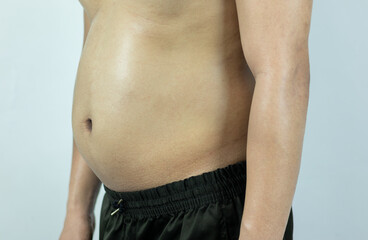 Naklejka premium Men with pot bellies or belly fat. Close-up of body parts