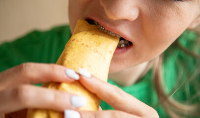 Closeup of woman in dental braces eating twister wrap