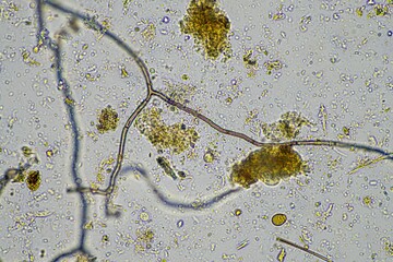 microscopic microorganisms under the microscope in a soil sample
