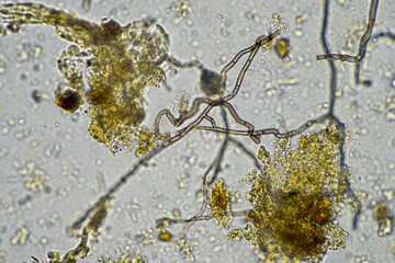 microscopic fungus and microorganisms in a sample