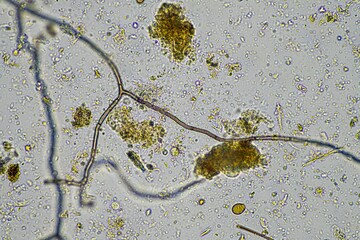 microscopic fungus and microorganisms in a sample