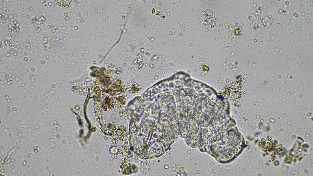 soil microorganisms under the microscope, including, fungi hyphae