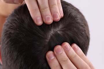 Fototapeta premium Man examining his hair and scalp on white background, closeup