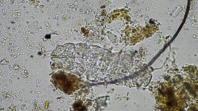 soil microorganisms under the microscope, including, fungi hyphae