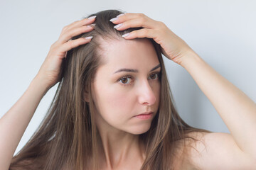 young pretty brunette woman suffering from hair loss spreads her hair in the temple area with both...